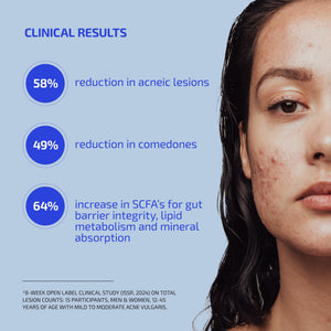 Codex Labs Shaant Clear Skin Supplement – 60 Vegan Capsules | Acne Probiotics with 9-Strain Blend, Green Tea EGCG & Guggul – Daily Support for Acne-Prone Skin & Clear Complexion Codex LabsBuy Supplements Australia