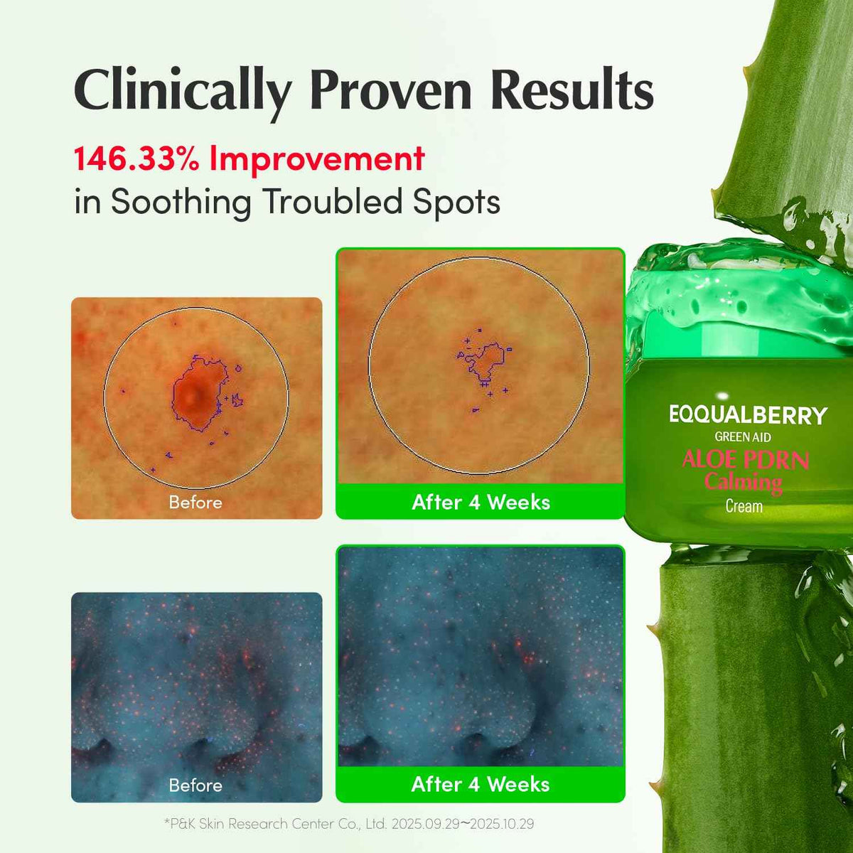 EQQUALBERRY ALOE PDRN Calming Cream | 7% Aloe PDRN & 10% Aloe Vera Water + 5-Cica | Cooling Gel Moisturizer for Oily Skin, Barrier Repair & Blemish Marks