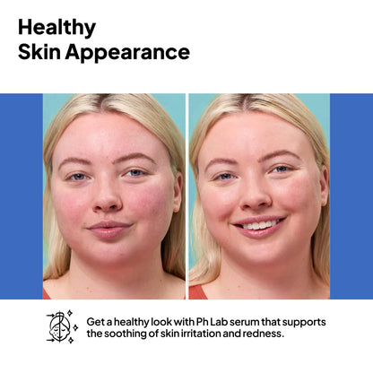 PhLab Anti Redness Serum, Reduces Capillary Cracks Appearance, Evens Skin Tone, Skin Soothing and Redness Reform Serum, 1.01 Fl Oz (Pack of 2)