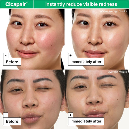 Dr.Jart+ Cicapair Sensitive Skin Korean Face Moisturizer for Redness and Barrier Repair with Centella Asiatica | Korean Skin Care | Travel Size, 0.51 Fl Oz