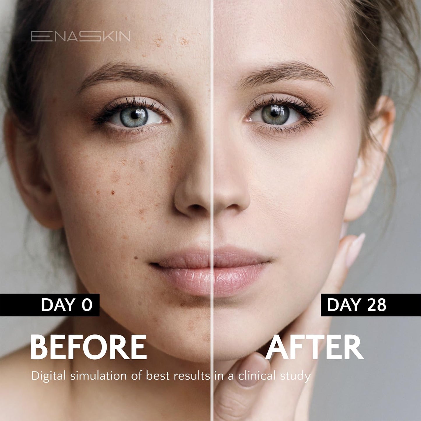 EnaSkin Dark Spot Remover Face & Body Serum: Age Spot Sun Spot Freckles Melasma Brown Spot