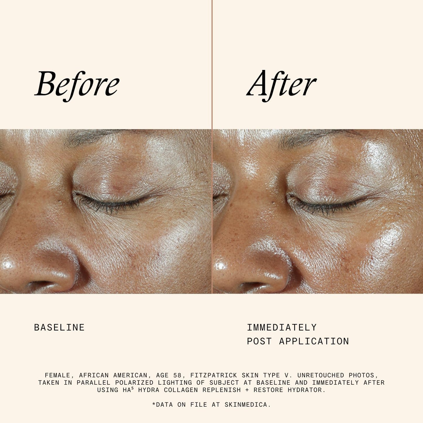 SkinMedica HA5 Hydra Collagen Hydrator with Vegan Collagen (NEW PACKAGING), Age-Defying Skincare for Women with Hyaluronic Acid