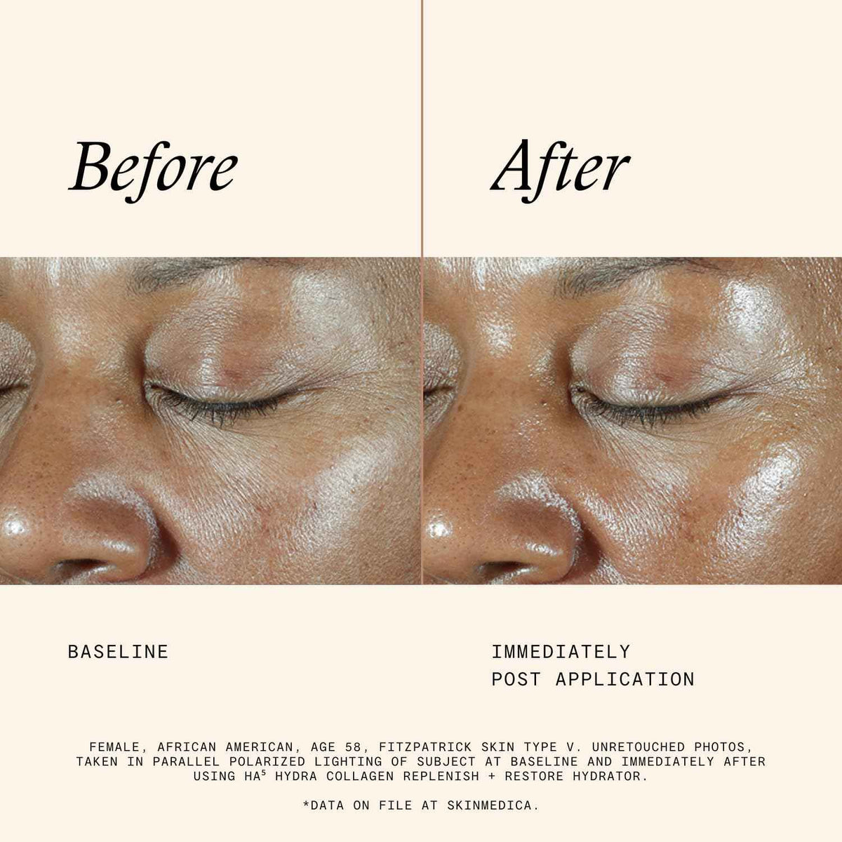 SkinMedica HA5 Hydra Collagen Hydrator with Vegan Collagen (NEW PACKAGING), Age-Defying Skincare for Women with Hyaluronic Acid