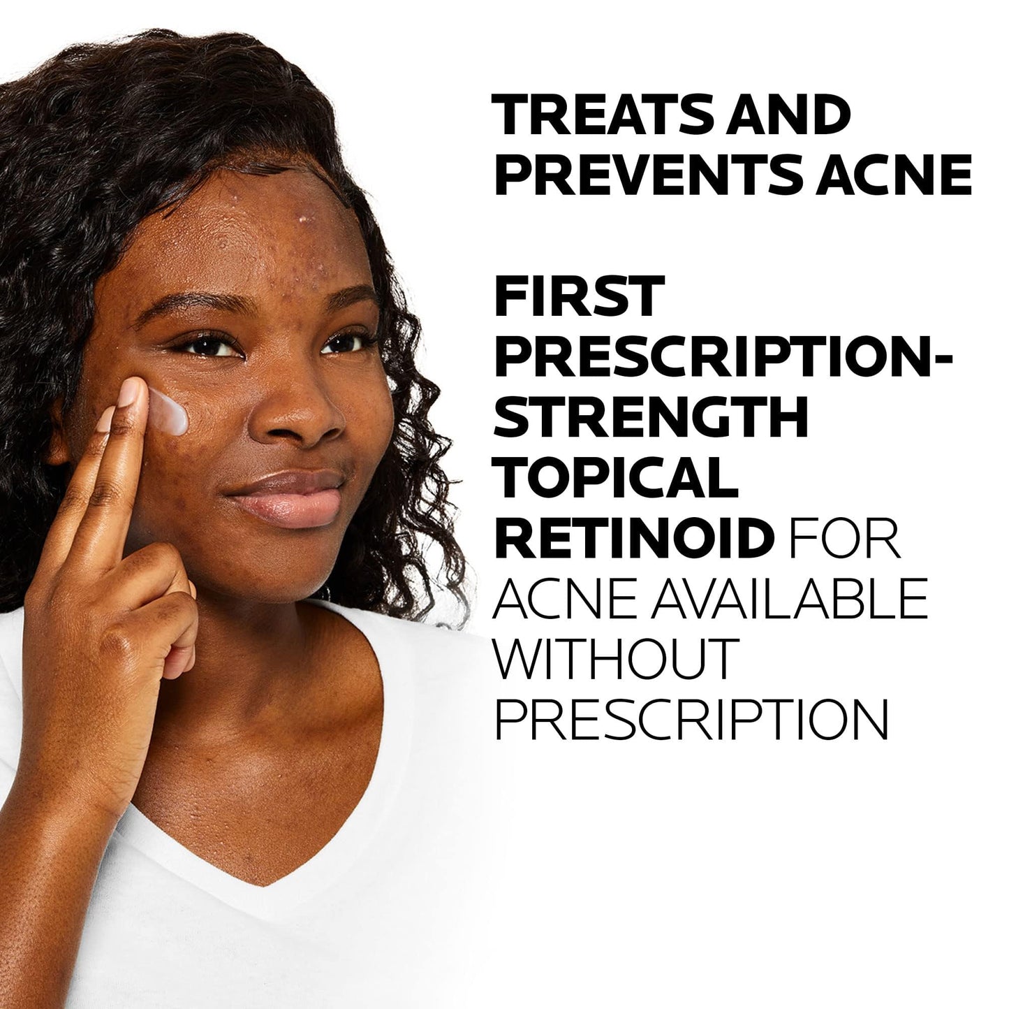 La Roche-Posay Effaclar Adapalene Gel 0.1% Acne Treatment, Retinoid Cream, Acne Medication Gel for Blackheads & Whiteheads, Oil Free, Helps Clear