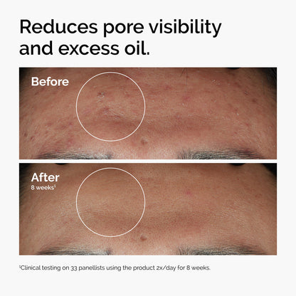 The Ordinary Serum Favorites Set – Hyaluronic Acid 2% + B5, Niacinamide 10% + Zinc 1%, Caffeine Solution 5% + EGCG Eye Serum, Serums for Hydrating,